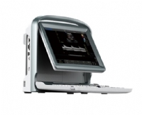 MÁY SIÊU ÂM 2D DOPPLER MÀU CHISON ECO5 VET